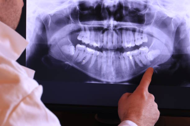 Best Chipped Tooth Repair Near Me  in Augusta, WI