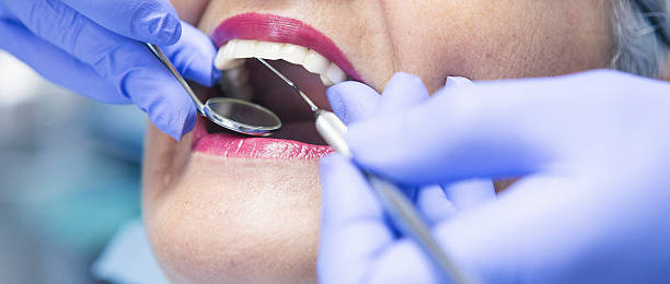Best Teeth Whitening  in Augusta, WI