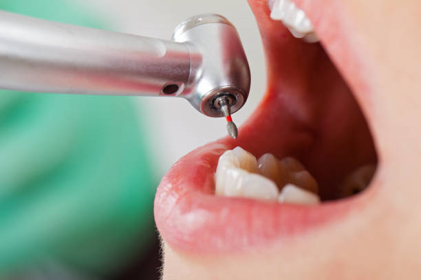 Best Dentist for Tooth Abscess  in Augusta, WI